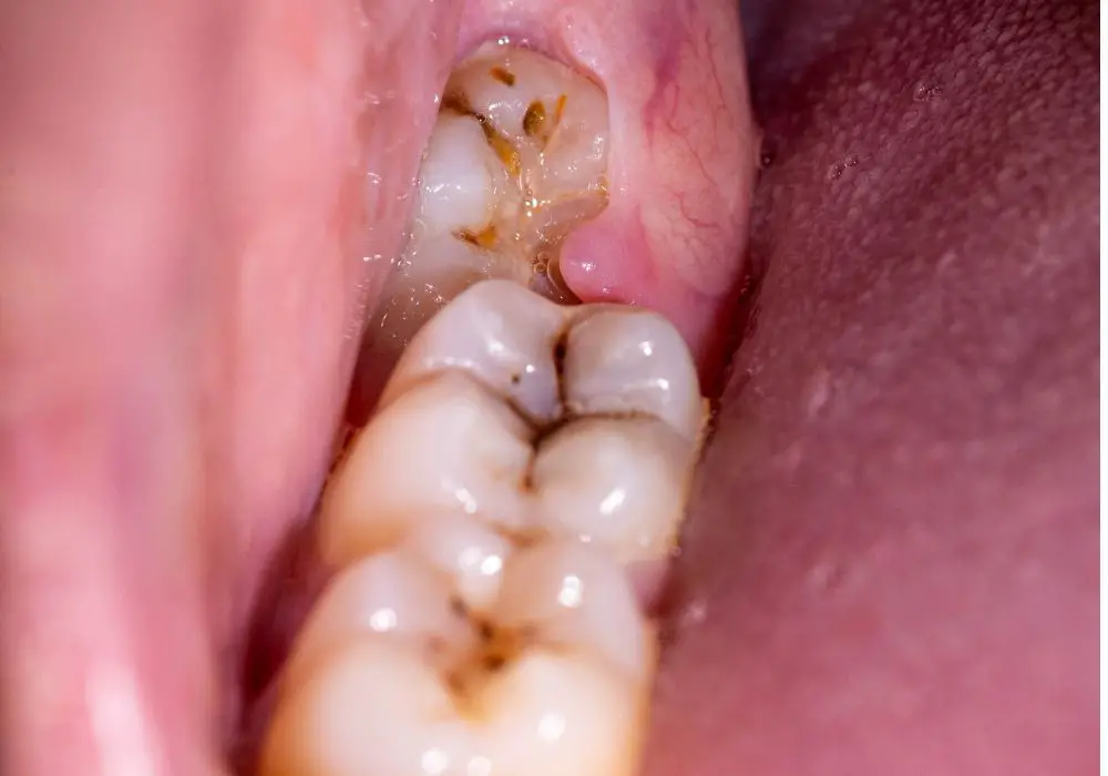 How is pathologic tooth movement managed?