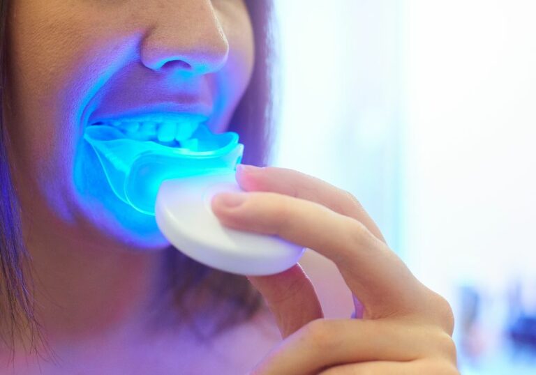 How Long Can You Leave Blue Light on Teeth? (Recommended Exposure Time)