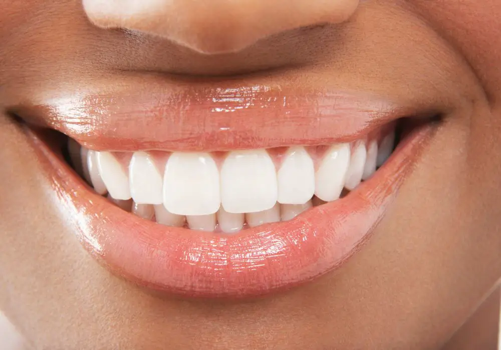 How long does dental varnish last on teeth