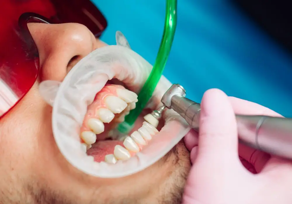 How long should I wait before eating after a dental cleaning?