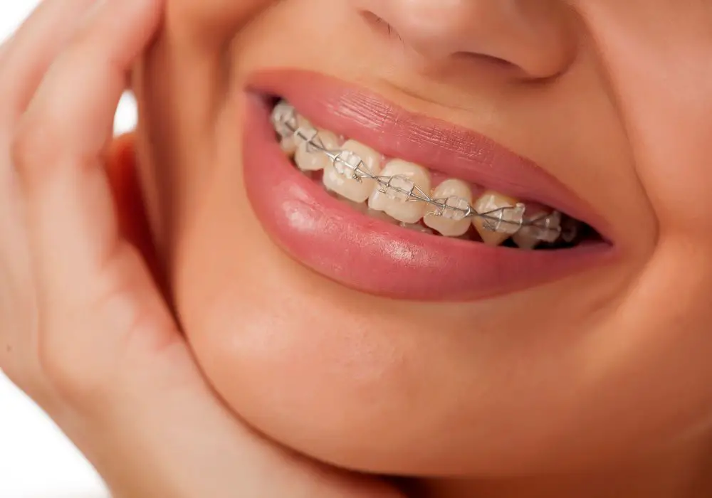 How orthodontic braces move teeth
