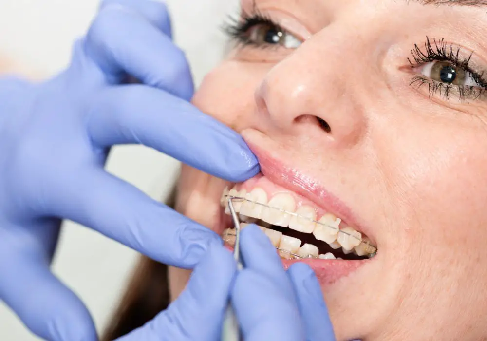 How teeth age impacts contouring options
