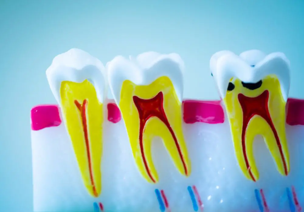 Implications for Dental Health