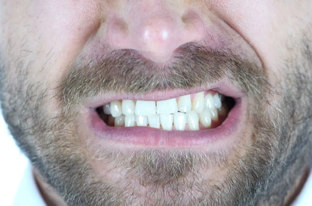 Implications of Having 15 Bottom Teeth