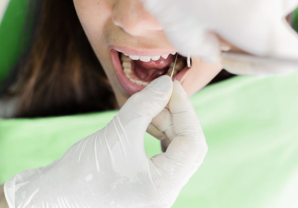 Key Reasons Dentists May Need to Extract Teeth