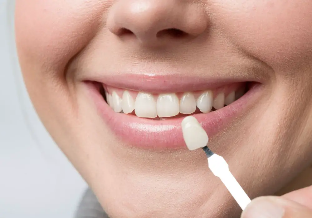 Long-Term Diet and Nutrition with Dental Veneers