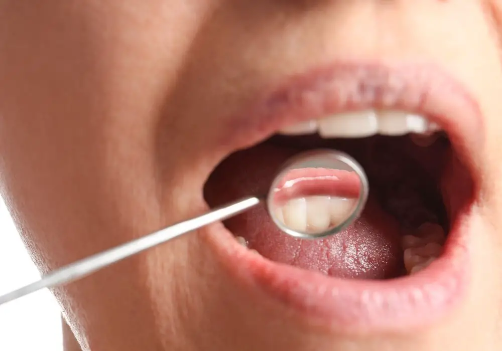 Long-Term Implications of Smoking on Dental Health