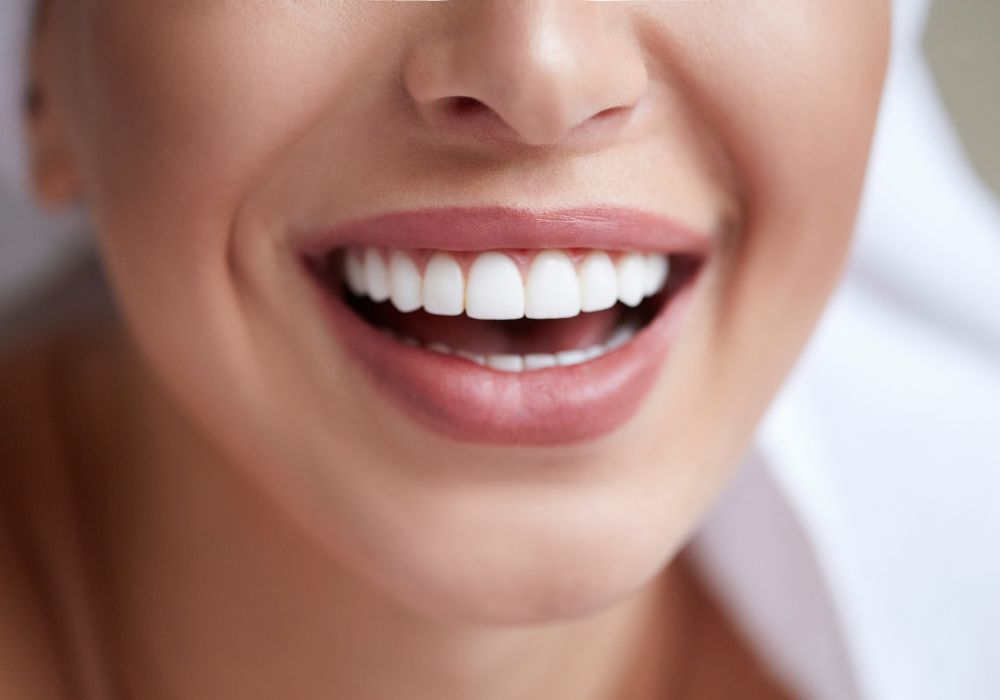 Long-Term Maintenance Between Whitening Sessions