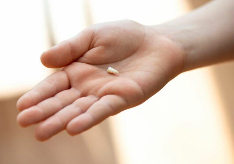 Why Does Dustin Lose His Teeth Twice? (Reasons Explained)