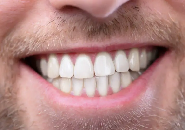 Why Does Denmark Have The Healthiest Teeth? (8 Key Factors)