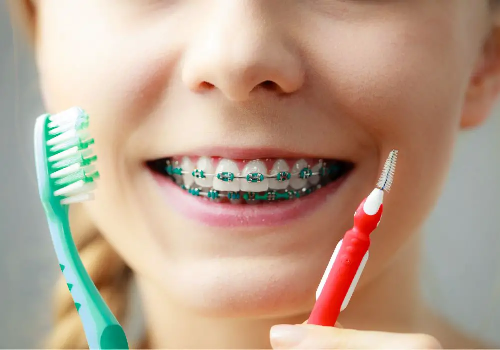 Maintaining Proper Oral Hygiene With Braces
