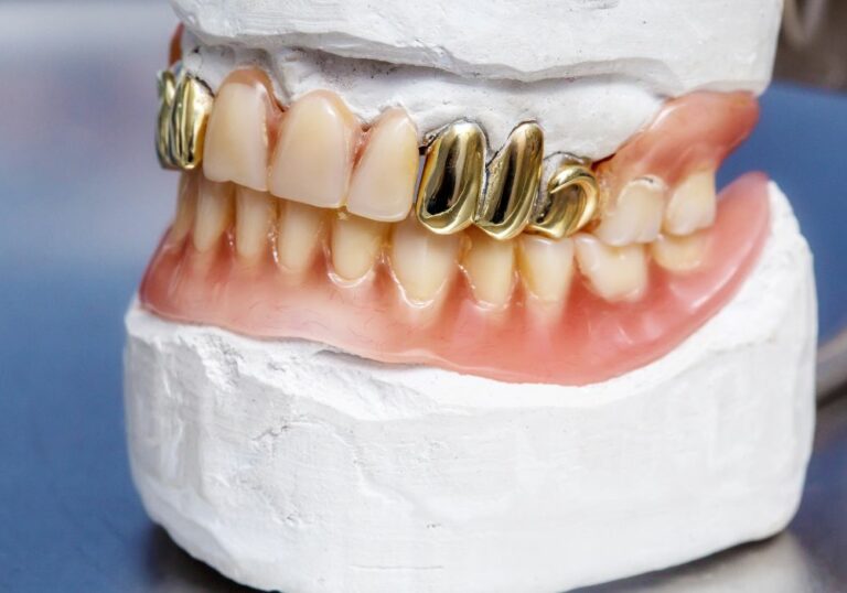 How Much Is A Gold Canine Tooth? (Ultimate Guide)