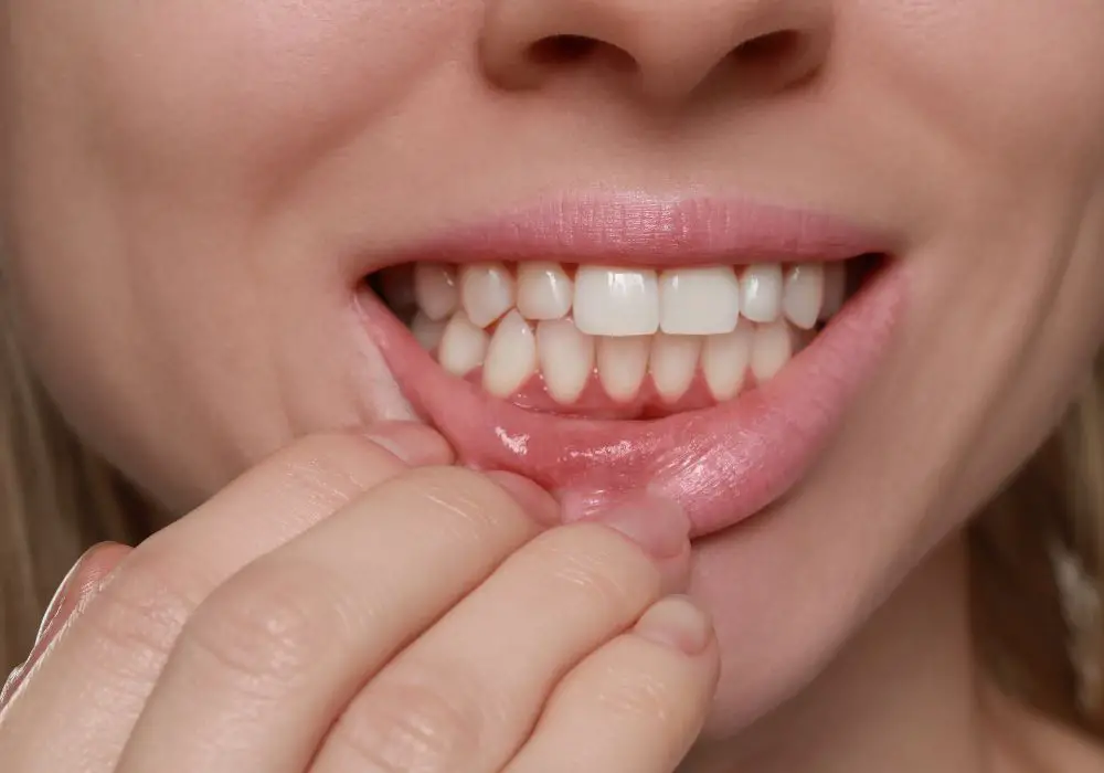 Medical Procedures for Restoring Black Gums