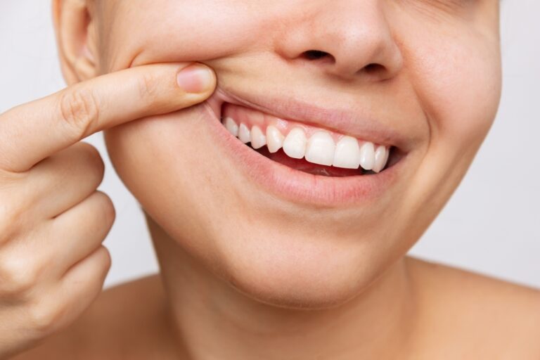 Natural Ways to Achieve Healthy Teeth and Gums