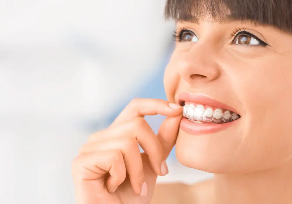 Planning Invisalign Treatment Around Prosthetic Teeth