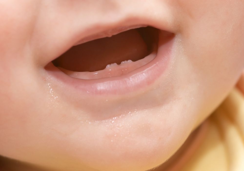 Potential Risks and Complications of Natal Teeth