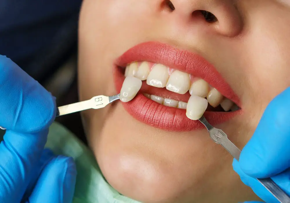 Potential Risks and Side Effects of Teeth Whitening