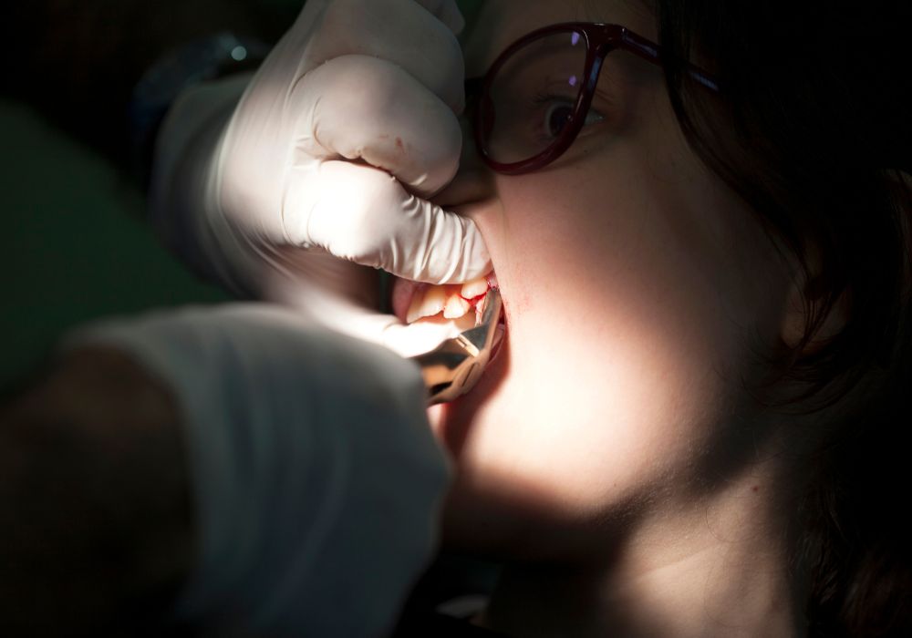 Practical Considerations for After a Tooth Extraction