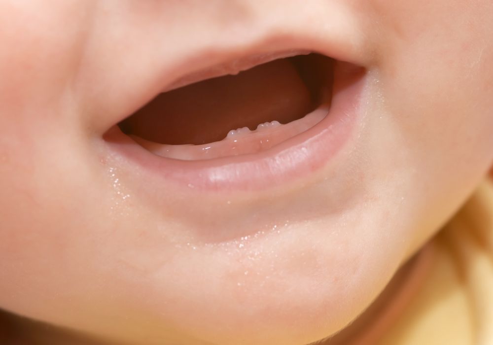 Primary Teeth Formation, Eruption, and Exfoliation