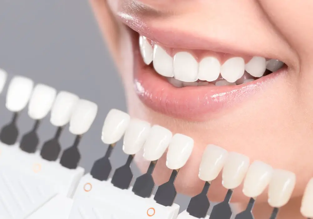 Professional Whitening From Your Dentist