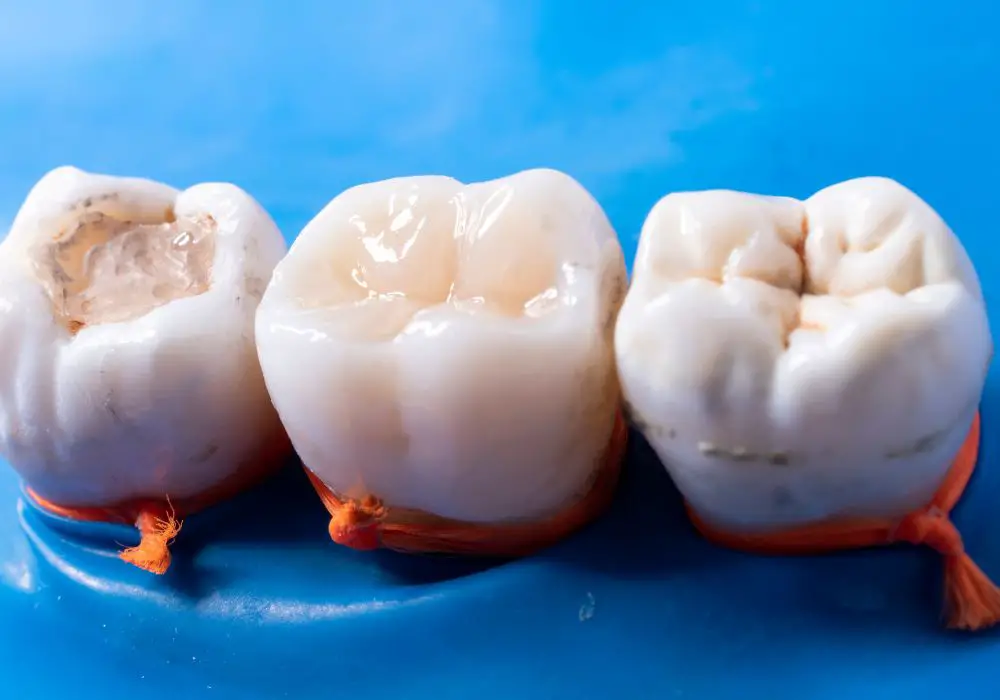 Professional solutions for restoring enamel