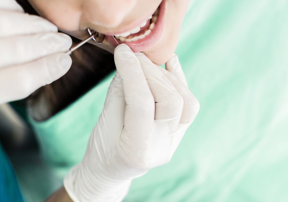 Professional treatment options for damaged teeth