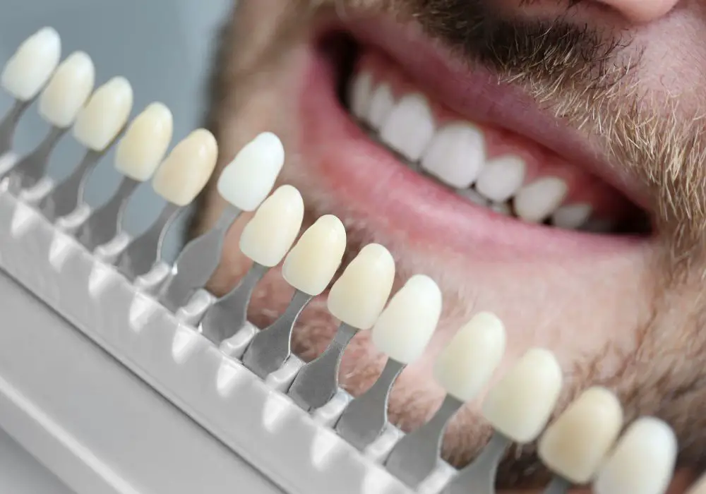 Repair Damage with Dental Bonding and Veneers