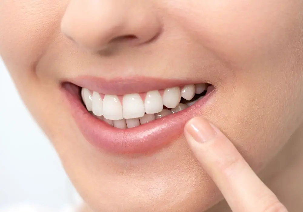 Risks Associated with Whitening Porcelain