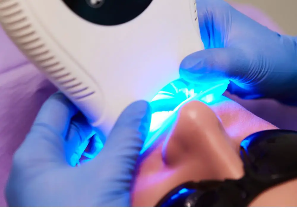 Safety Precautions for Teeth Whitening