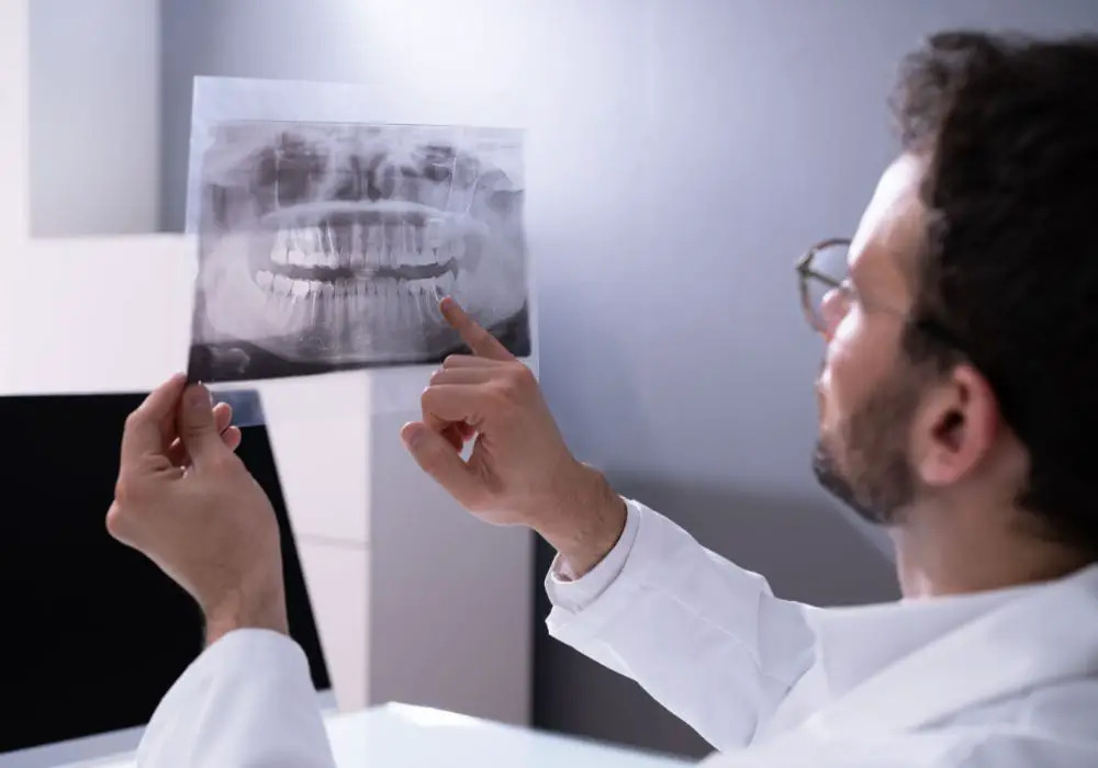 Severe complications from impacted wisdom teeth