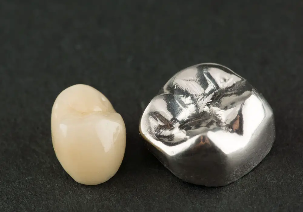 Signs of Tooth Decay Under a Silver Cap
