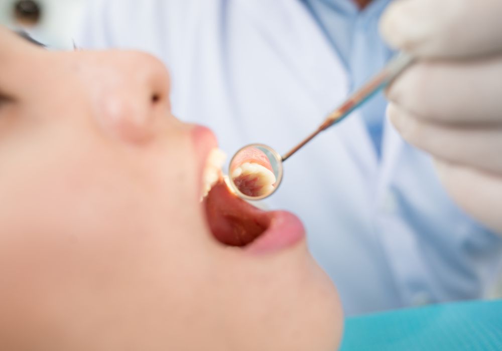Signs you may have a cavity requiring treatment