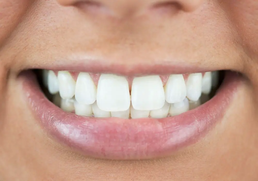 Step-By-Step Guide to Painting Your Teeth White
