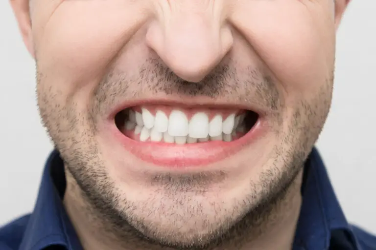 Stop Grinding Your Teeth with These Home Remedies