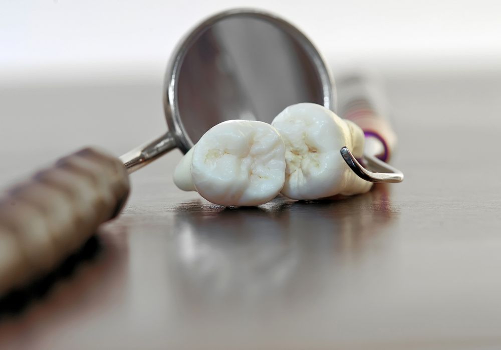 Strategies to reduce wisdom teeth costs