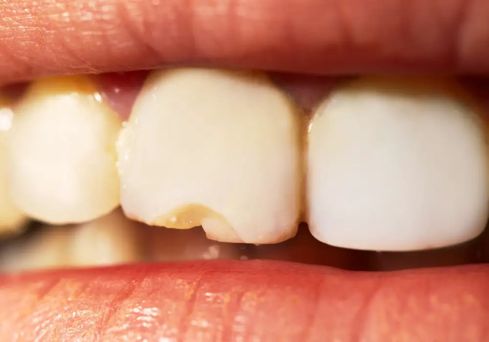 Success rates for fractured tooth repair