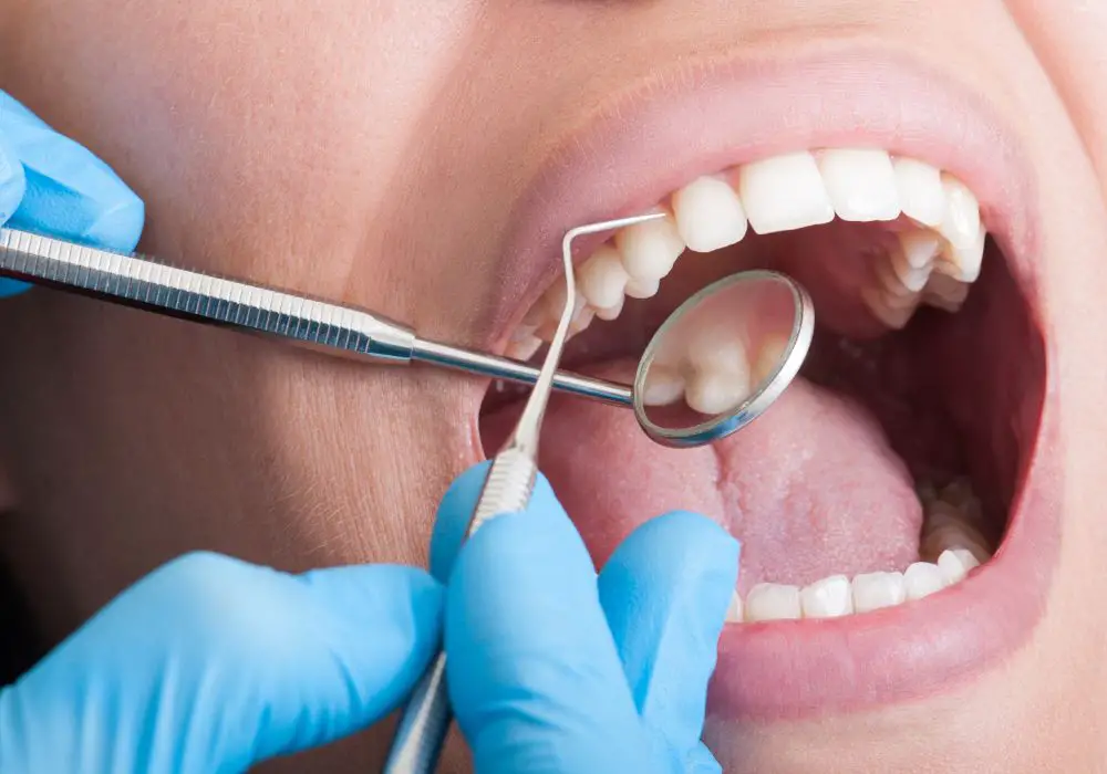 Teeth Most Prone to Root Canals