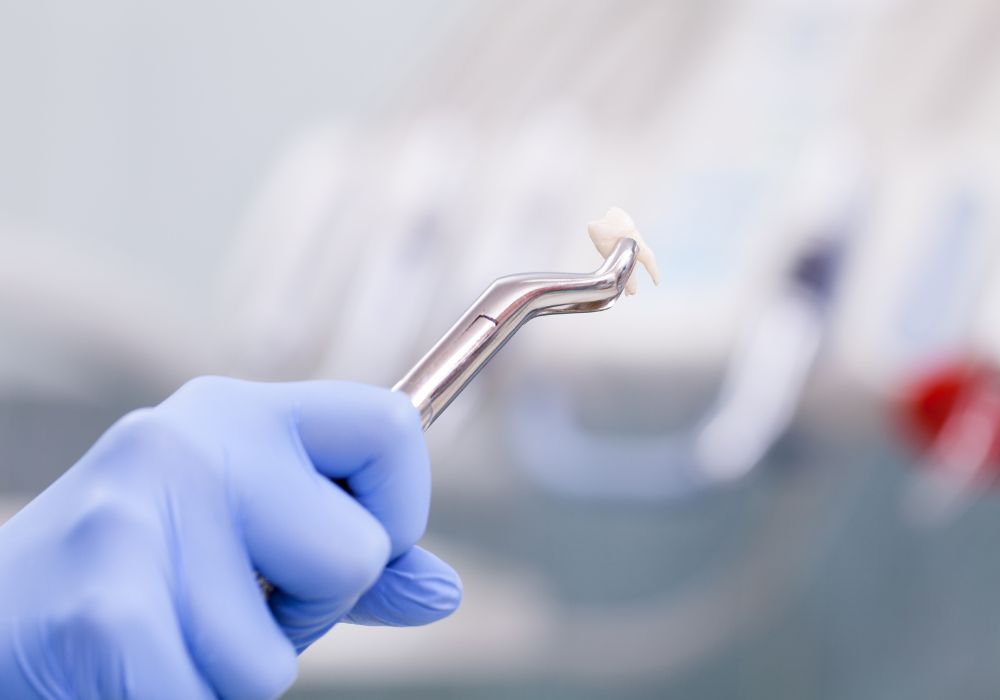 The tooth extraction procedure