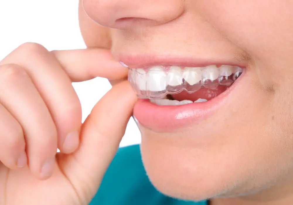 Tips for preventing tooth movement with retainers