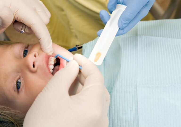 can-i-leave-fluoride-on-my-teeth-overnight-benefits-risks
