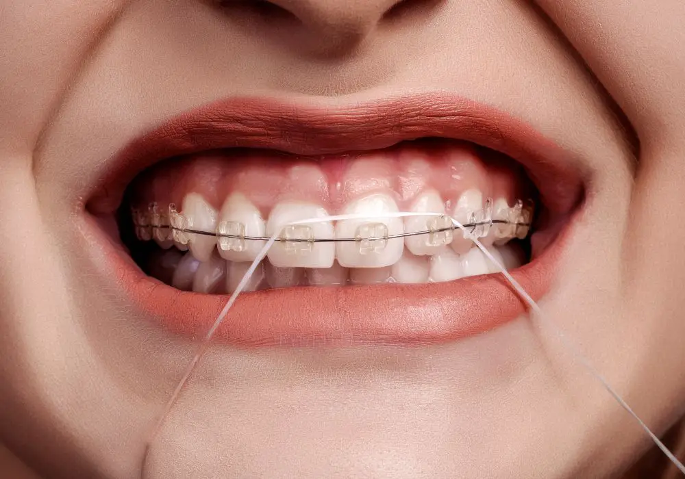 Tips to Prevent Post-Flossing Discomfort