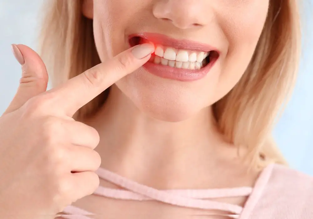 Treating receding gums