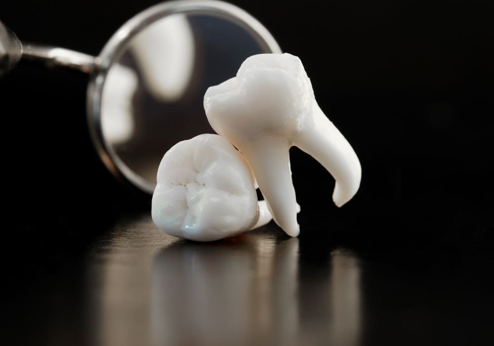 Typical wisdom tooth development timeline