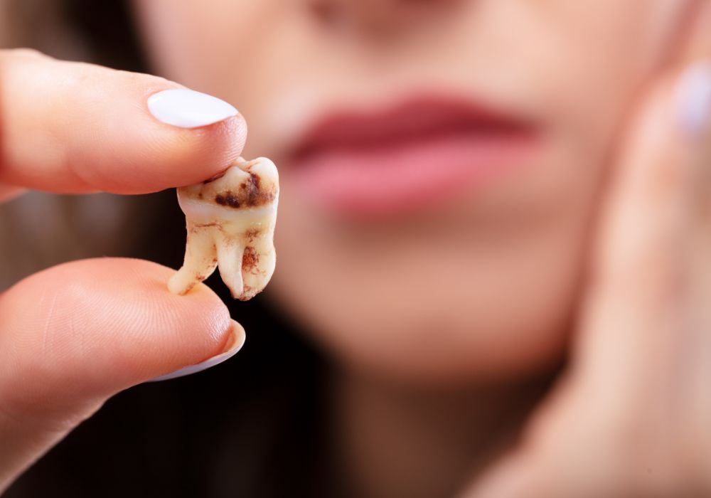 Can One Rotten Tooth Affect Others? Exploring the Connection Between Dental  Health and Overall Wellness