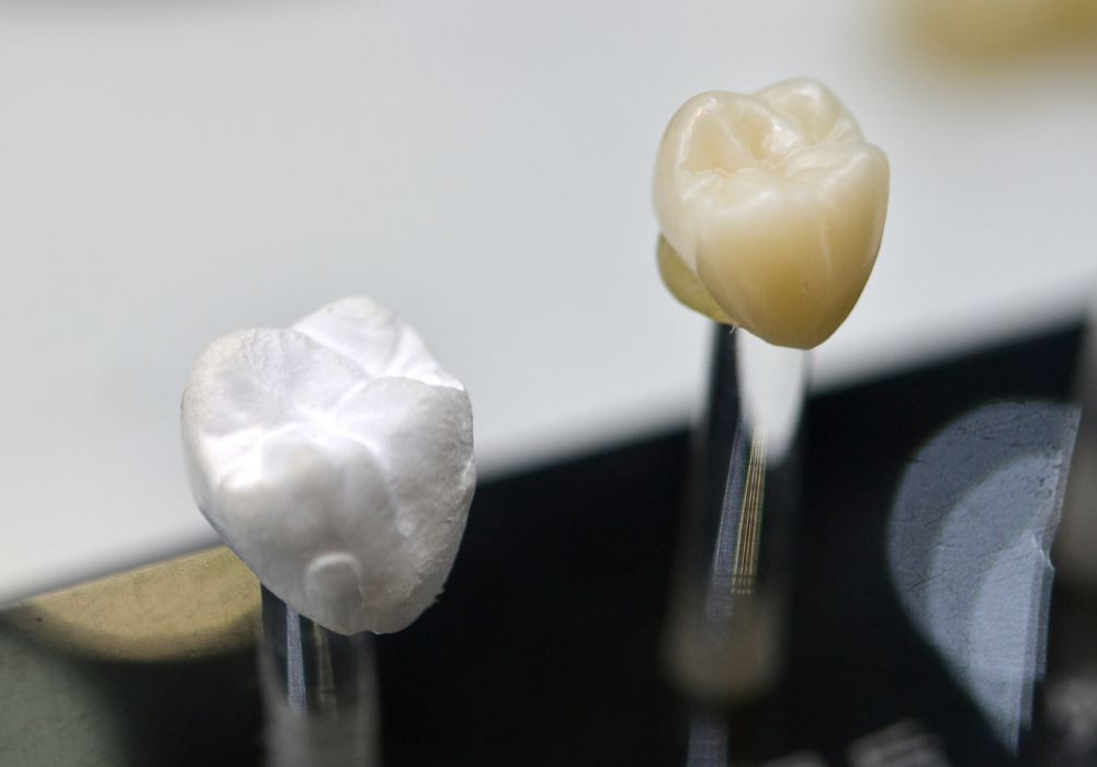 Understanding Dental White Caps