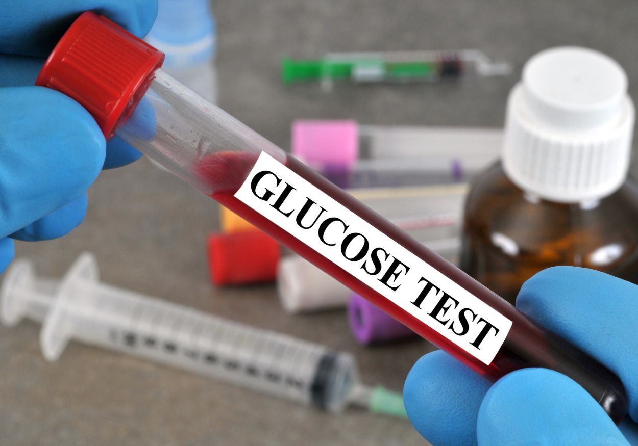 Understanding Glucose Tests