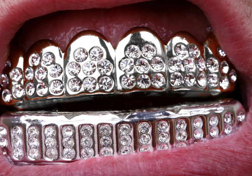 Understanding Permanent Diamond Teeth