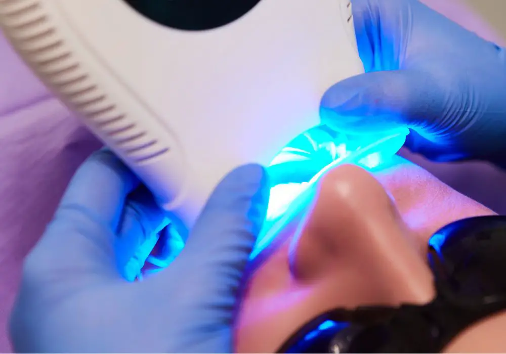 Understanding Teeth Whitening