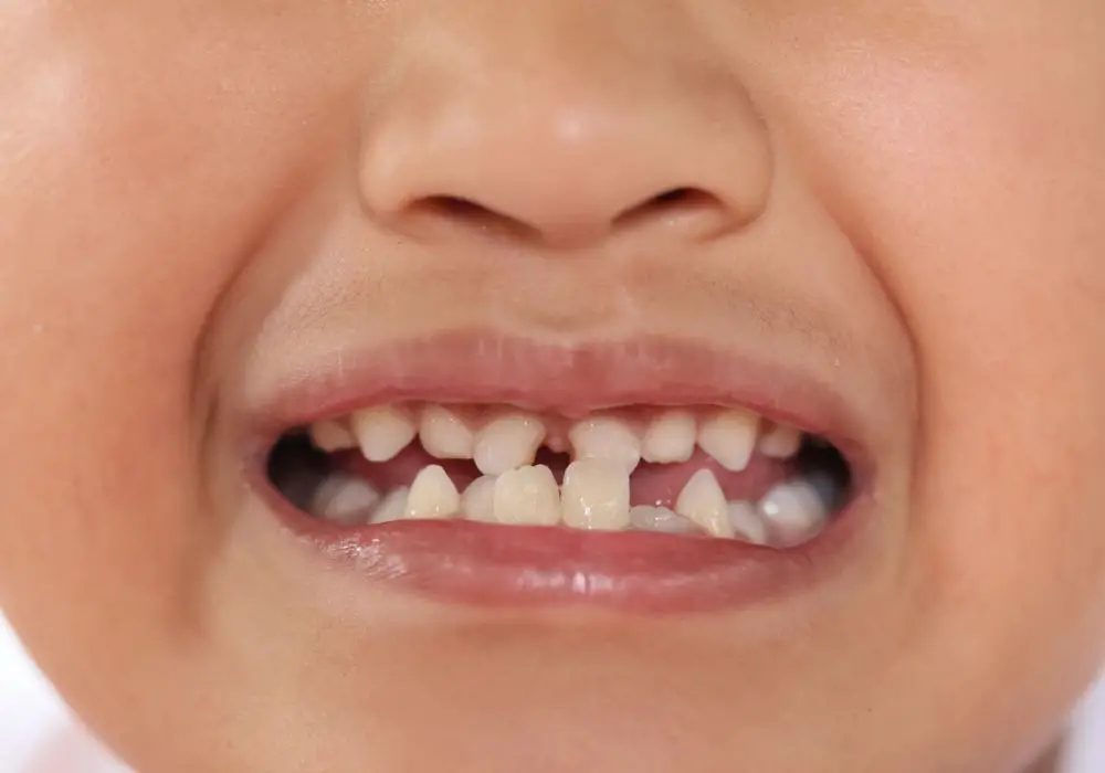 Understanding Tooth Development