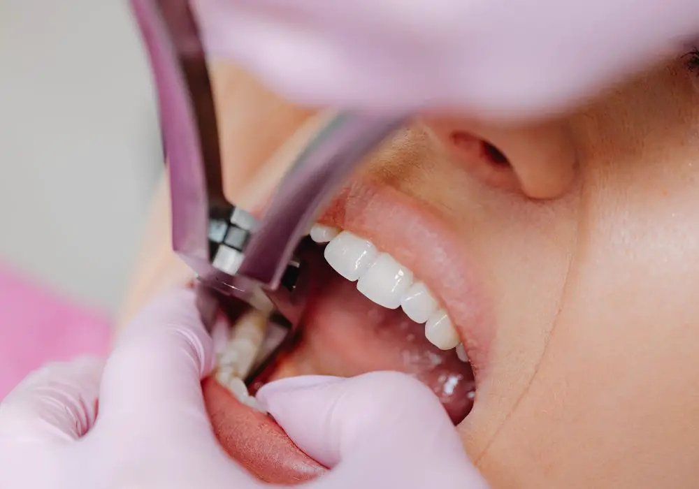 Understanding Tooth Extraction